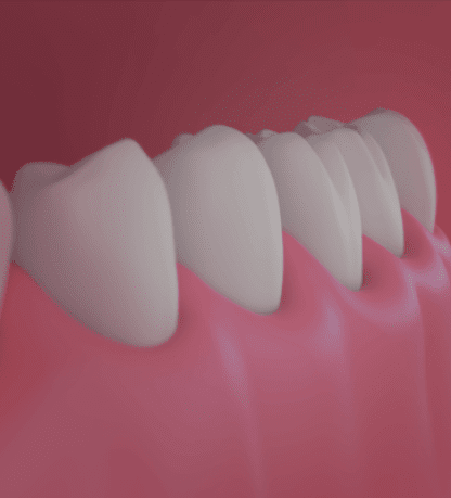 Treatment - Beverley House Dental