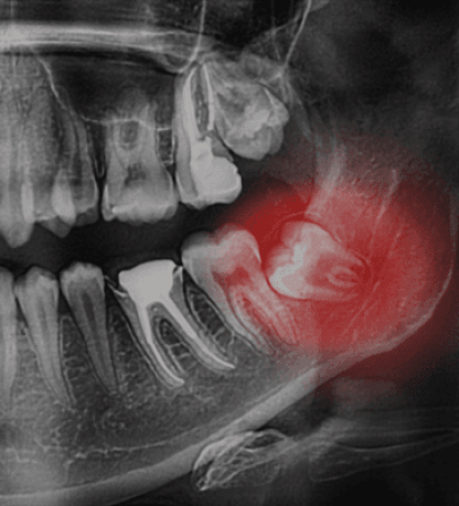 Treatment - Beverley House Dental